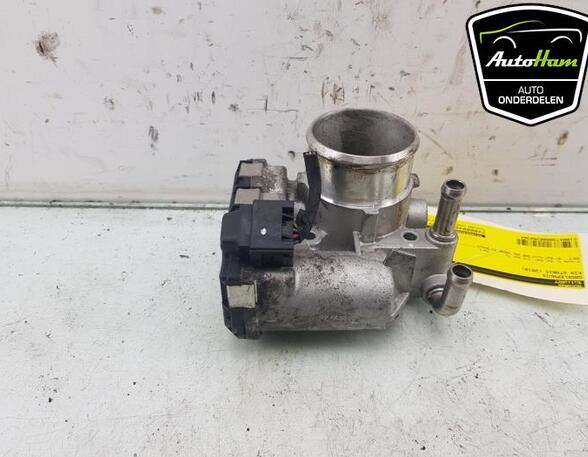 Throttle Body HYUNDAI i20 (GB, IB), HYUNDAI i20 ACTIVE (IB, GB), HYUNDAI i20 II Coupe (GB), KIA STONIC (YB)